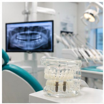 Dental implant treatment and planning