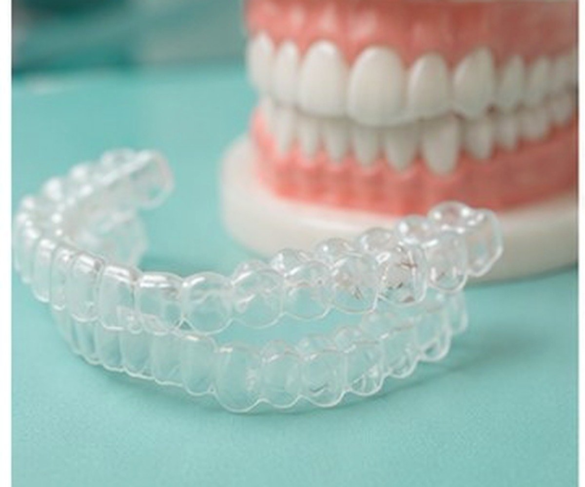 Clear Aligners Pune dental care at Amayra Polyclinic & Dental Hub