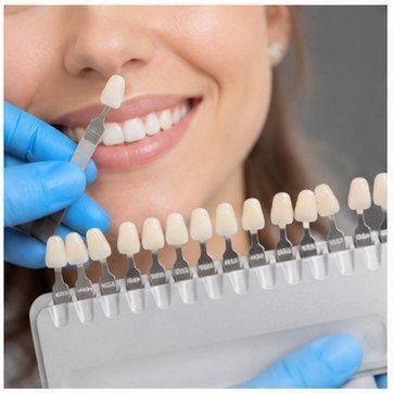 Cosmetic dentistry shade matching
