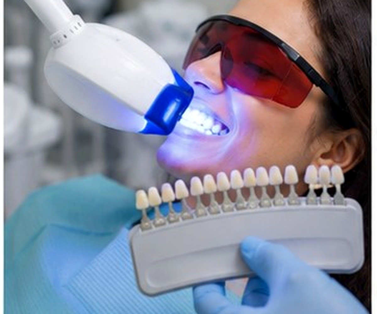 Teeth Whitening Pune dental care at Amayra Polyclinic & Dental Hub